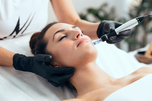 micro-needling, hyperpigmentation, acne treatments, microdermabrasion, microneedling