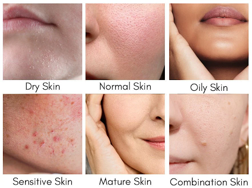 skin types, skin analysis, anti-aging skincare, sensitive skin, skincare tips, combination skin, dry skin, normal skin, oily skin, personalized skincare